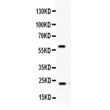 RAB11A Antibody (aa171-211)