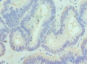 Polyclonal Rabbit anti-Human PAK1 Antibody (aa1-240, IHC)