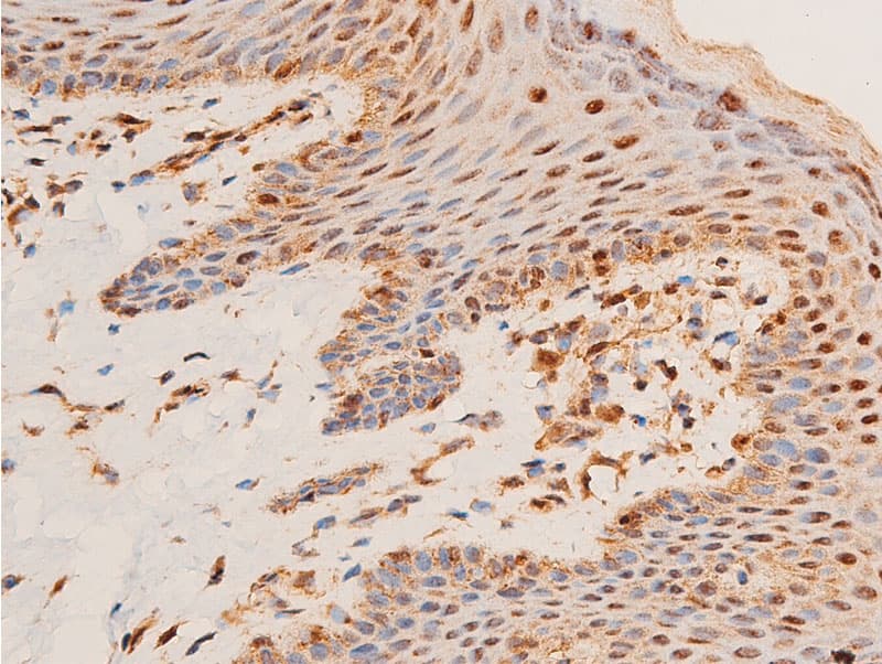 Polyclonal Rabbit anti-Human CHEK1 / CHK1 Antibody (phospho-Ser296, IHC, IF, WB)