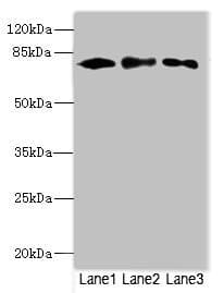 CALCOCO1 / CoCoa Antibody