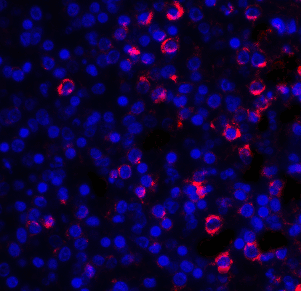 IHC-plus™ Polyclonal Rabbit anti-Human CD28 Antibody (IHC, IF, WB)