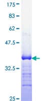 Human ERG Protein (Recombinant GST, N-terminus)