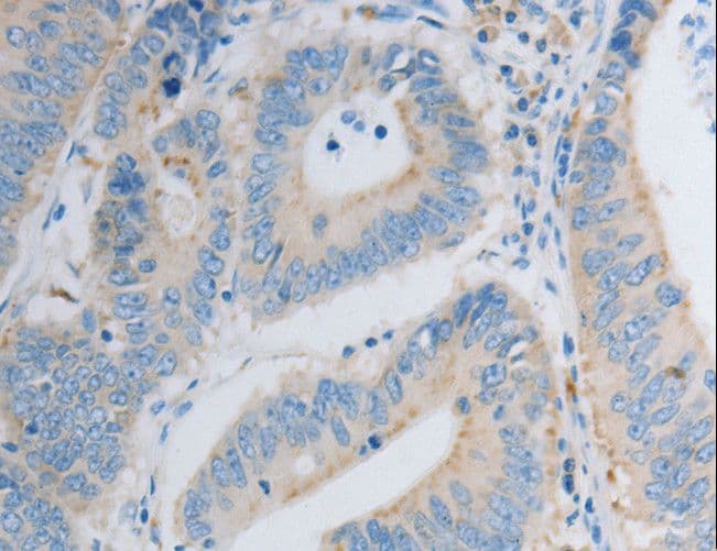 PDX1 Antibody