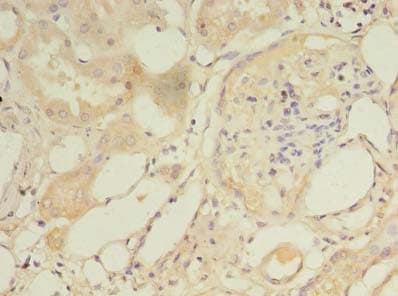 Polyclonal Rabbit anti-Human TSC501 / NAT8 Antibody (IHC)