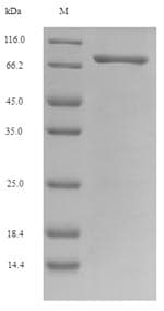 Mouse OCM / Oncomodulin Protein (Recombinant 6His-SUMO, N-terminus)