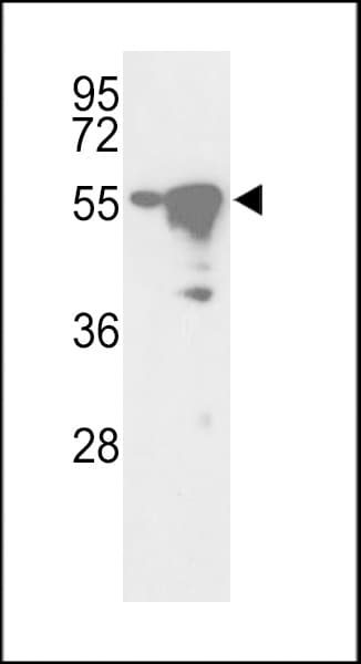 IHC-plus™ Polyclonal Rabbit anti-Human STK25 Antibody (aa325-356, IHC, WB)
