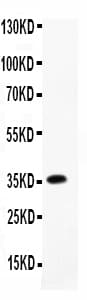 CNTF Antibody (aa2-198)