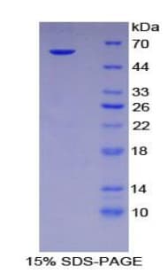Mouse SPINK5 / LEKTI Protein (Recombinant His-GST)