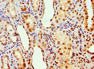 PHAP1 / ANP32A Antibody (aa1-170)