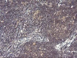 PDLIM2 / SLIM Antibody (clone OTI3B5)