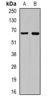Polyclonal Rabbit anti-Human CEP57L1 Antibody (IHC, WB)