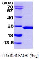 Human NUDT16 Protein (Recombinant His)
