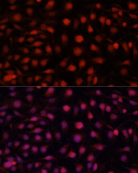 NOS3 / eNOS Antibody