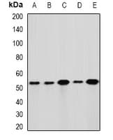 Polyclonal Rabbit anti-Human GLUD1/Glutamate Dehydrogenase Antibody (IHC, WB)