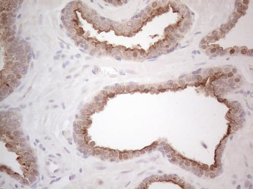 ABCC5 / MRP5 Antibody (clone OTI2C8)