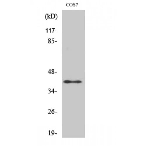 ADH7 Antibody (180-260 aa, Internal)