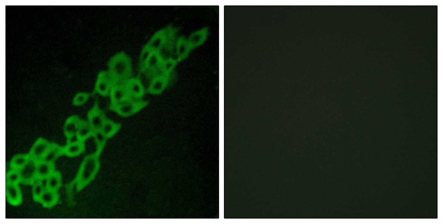 Polyclonal Rabbit anti-Human GPR32 Antibody (aa151-200, IF, WB)