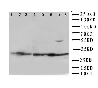 VDAC1 / PORIN Antibody (aa163-178)