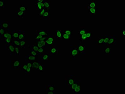 Polyclonal Rabbit anti-Human H1F0 Antibody (IHC, IF, WB)
