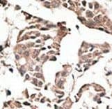 AUTL1 / ATG4C Antibody (aa33-62)