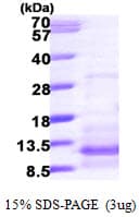 Human CCL20 / MIP-3-Alpha Protein (Recombinant His)