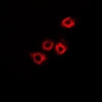 HADHB Antibody