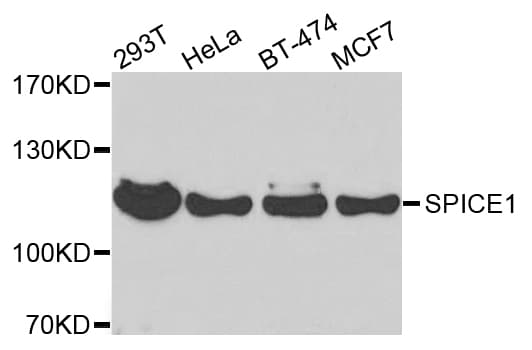 SPICE1 / CCDC52 Antibody