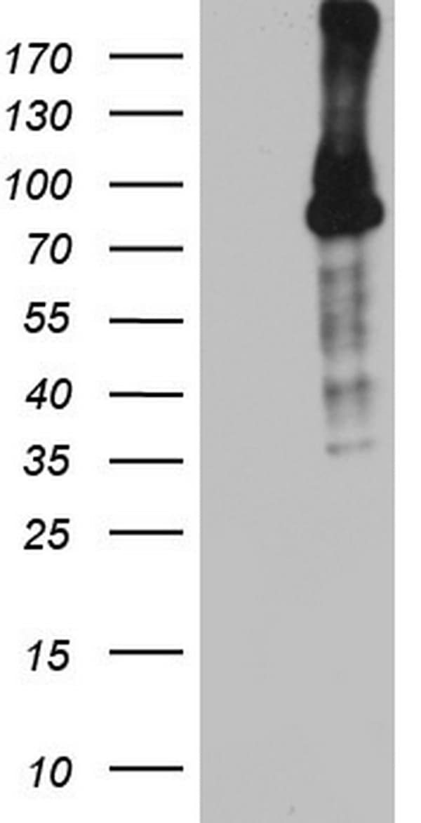 BCL6 Antibody (aa1-300, clone OTI11D8)