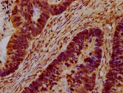 Polyclonal Rabbit anti-Human CEB1 / HERC5 Antibody (IHC, IF)