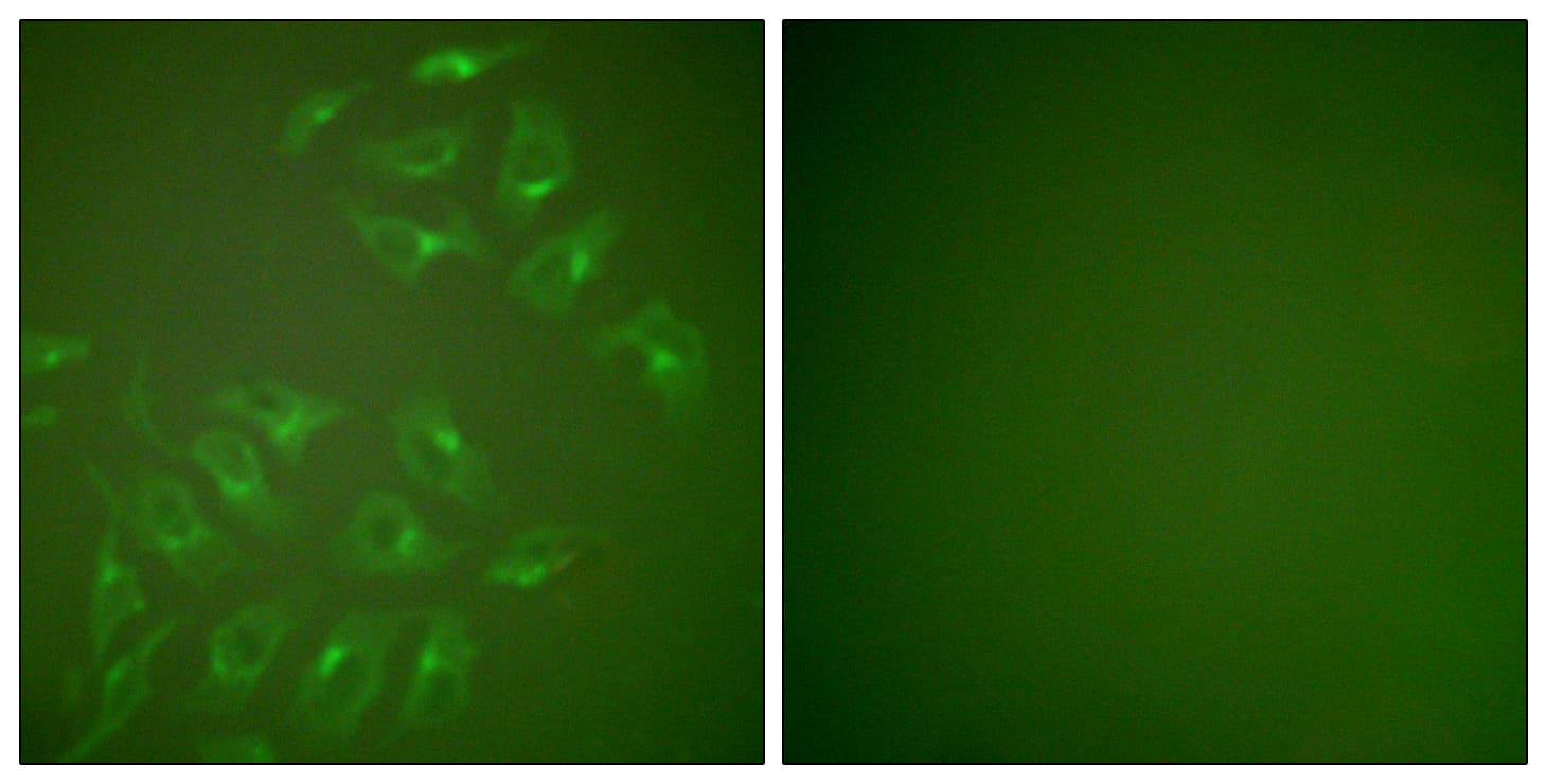 Polyclonal Rabbit anti-Human MMP13 Antibody (aa10-59, IHC, IF, WB)
