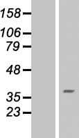 RNF175 Protein (Over-Expression Lysate Myc-DDK (Flag))