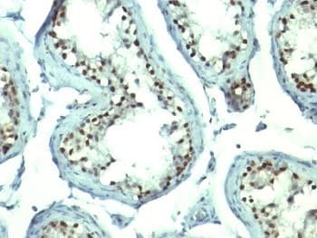 NCL / Nucleolin Antibody (clone NCL/902, Ready-to-Use)
