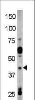 RAD9A / RAD9 Antibody (phospho-Tyr28)