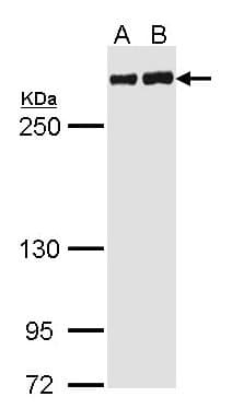 IHC-plus™ Polyclonal Rabbit anti-Human FLNA / Filamin A Antibody (IHC, IF, WB)
