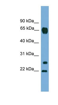 MMP26 Antibody (C-Terminus)