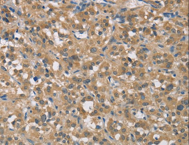 TRAIL-R4 / DCR2 Antibody
