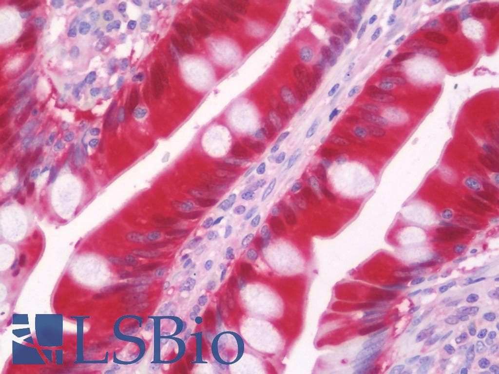 IHC-plus™ CBR3 Antibody (clone 1G6)