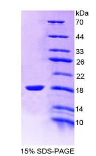 Rat ALK3 / BMPR1A Protein (Recombinant His-T7)