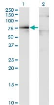 Monoclonal Mouse anti-Human DMD / Dystrophin Antibody (clone 3A11, WB)