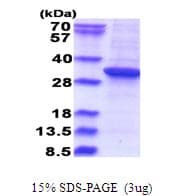 Human RSU1 Protein (Recombinant His)