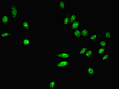 IHC-plus™ PARN Antibody