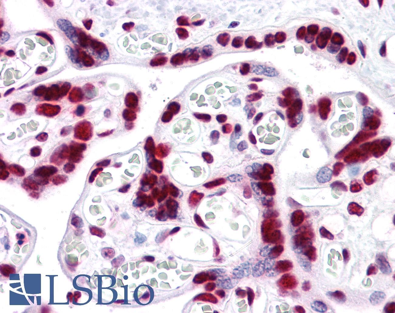 IHC-plus™ HMG1 / HMGB1 Antibody (clone 1B11)
