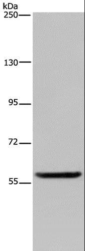 LBR / Lamin B Receptor Antibody