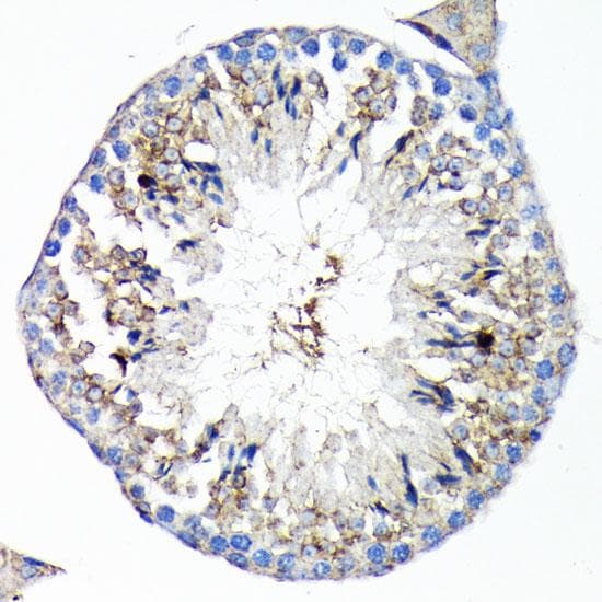 TNFRSF1A / TNFR1 Antibody