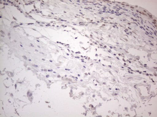 IRS1 Antibody (aa1-280, clone OTI2B10, Carrier-free)