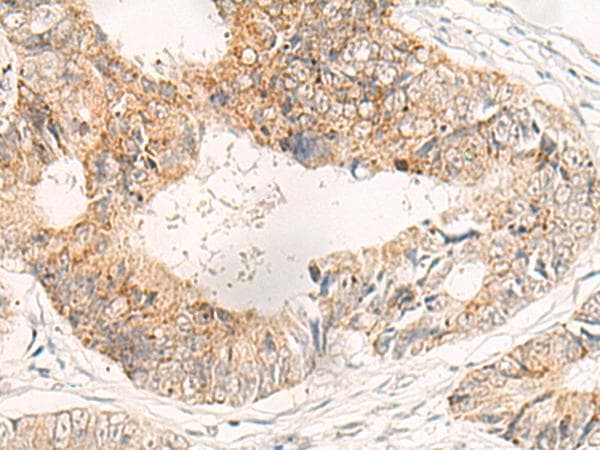 ADAMTS2 Antibody