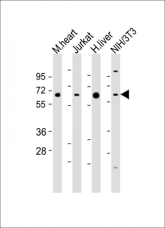 Polyclonal Rabbit anti-Human PGM1 / Phosphoglucomutase 1 Antibody (aa469-501, IHC, WB)