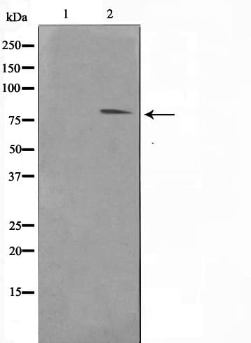 Polyclonal Rabbit anti-Human STAT1 Antibody (phospho-Tyr701, IHC, IF, WB)