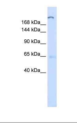 Polyclonal Rabbit anti-Human ATP10D Antibody (FITC, aa1154-1203, IHC, WB)