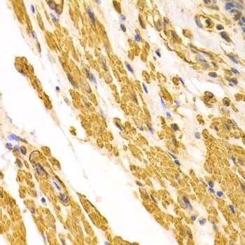 CYP2E1 Antibody